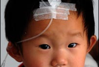 BBC：中国已有34名儿童死于手足口病
