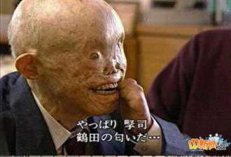 老照片:惨遭原子弹轰炸后的日本市民