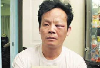 温哥华华裔市民：警无故施暴 左眼重伤