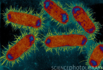 世界日报：感染新超级细菌 加发现2例