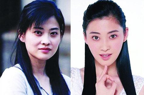 盘点那些曾“磨骨”的女星 大饼脸变瓜子脸(组图)