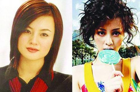 盘点那些曾“磨骨”的女星 大饼脸变瓜子脸(组图)