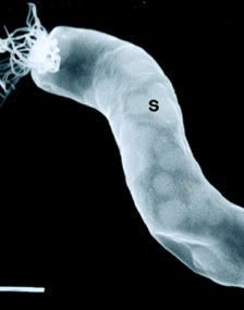 这是地球上一种巨型细菌Titanospirillum velox的照片。胡佛博士宣称他在扫描隧道电子显微镜下看到一块陨石上存在某种与之大小和结构都非常类似的特征