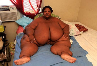 美胖妈近300公斤16年没出门终日赤裸