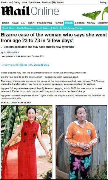 越南女子吃海鲜引怪病几月内从少女变老妇(图)