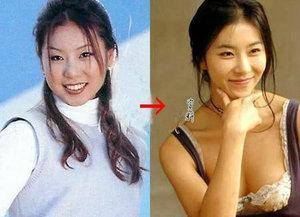 韩国首批整容者遭遇后遗症 美女变加菲猫(组图)