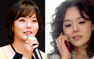 韩国首批整容者遭遇后遗症 美女变加菲猫(组图)