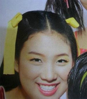 韩国首批整容者遭遇后遗症 美女变加菲猫(组图)