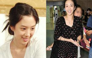 韩国首批整容者遭遇后遗症 美女变加菲猫(组图)
