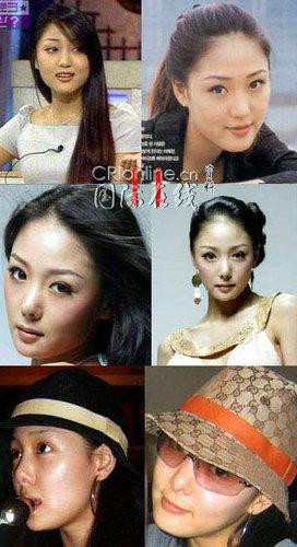 韩国首批整容者遭遇后遗症 美女变加菲猫(组图)