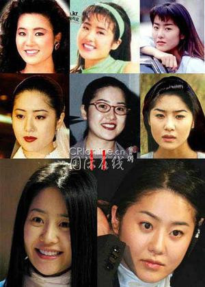 韩国首批整容者遭遇后遗症 美女变加菲猫(组图)