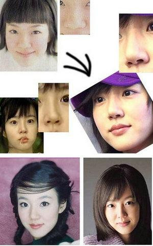 韩国首批整容者遭遇后遗症 美女变加菲猫(组图)