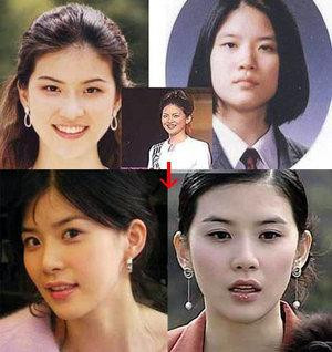 韩国首批整容者遭遇后遗症 美女变加菲猫(组图)