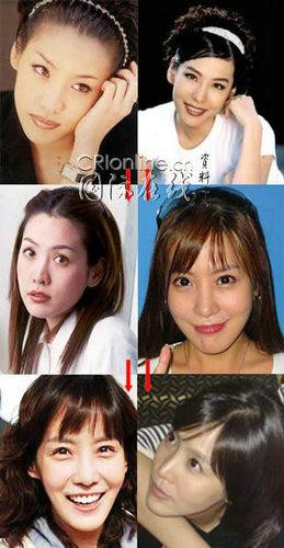 韩国首批整容者遭遇后遗症 美女变加菲猫(组图)