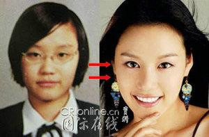 韩国首批整容者遭遇后遗症 美女变加菲猫(组图)