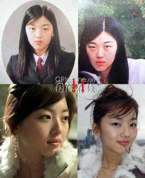 韩国首批整容者遭遇后遗症 美女变加菲猫(组图)