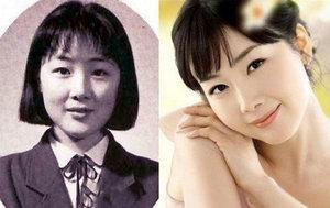 韩国首批整容者遭遇后遗症 美女变加菲猫(组图)