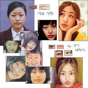 韩国首批整容者遭遇后遗症 美女变加菲猫(组图)