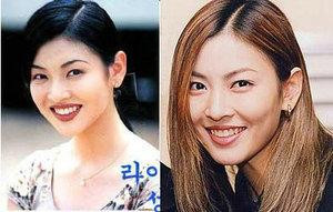 韩国首批整容者遭遇后遗症 美女变加菲猫(组图)