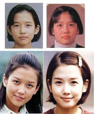 韩国首批整容者遭遇后遗症 美女变加菲猫(组图)