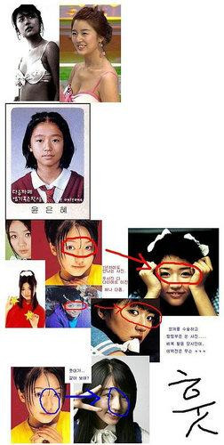 韩国首批整容者遭遇后遗症 美女变加菲猫(组图)
