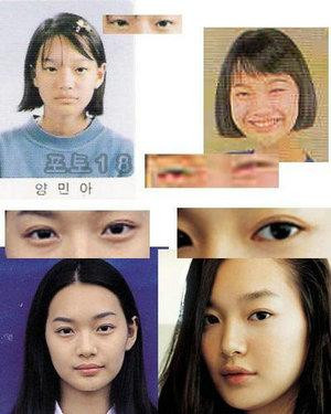 韩国首批整容者遭遇后遗症 美女变加菲猫(组图)