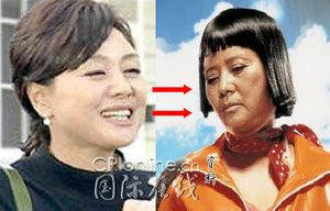 韩国首批整容者遭遇后遗症 美女变加菲猫(组图)