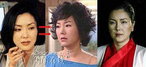 韩国首批整容者遭遇后遗症 美女变加菲猫(组图)
