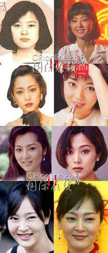 韩国首批整容者遭遇后遗症 美女变加菲猫(组图)