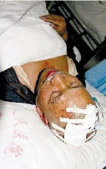 村干部酒后要拿村民嘴巴当“尿壶” 村民反抗被多人围殴