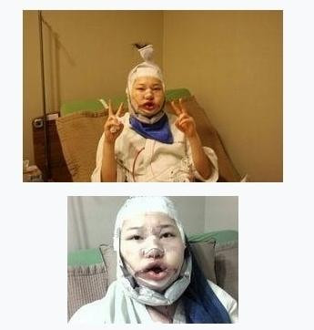 慎入！韩国女人整容全纪录：图解痛苦的蜕变过程(组图)