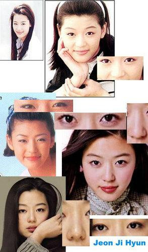 韩国首批整容者遇明显后遗症 面临“毁容”危机(组图)
