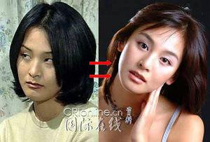 韩国首批整容者遇明显后遗症 面临“毁容”危机(组图)