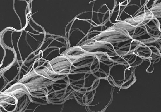 奇异动物精子:果蝇精子长6厘米 是身体的20倍长(组图)
