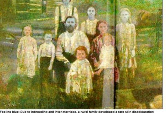 奇：美国200余年前曾存在蓝皮肤家族