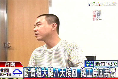 台一男子断臂植在大腿上8天后接回存活