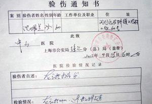 上海最高法院保安折断维权人士手指