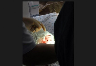 早产女婴遭割喉被弃垃圾桶 抢救存活