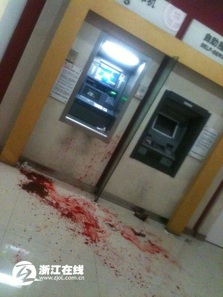 浙江宁波27岁女孩ATM取款遭割喉 颈动脉破裂大出血(图)