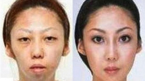 男子称女儿丑到不可思议 状告整容妻子获赔75万(图)