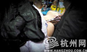 杭州1名男子开玩笑将剪刀扔向妻子 刺进乳房7厘米(图)