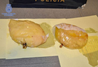 女子胸部植入1.8公斤毒品 通关时被抓