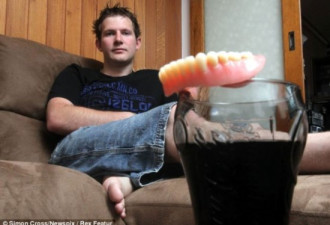 澳洲男子每天喝8公升可乐 牙齿全光光