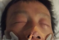 亚裔男子被冻伤 警方吁知情人提供线索
