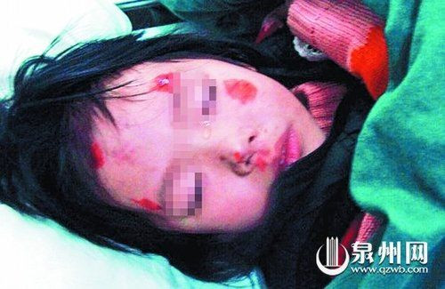 3岁女童被父亲暴打抛下车 父亲随后遇车祸身亡(图)