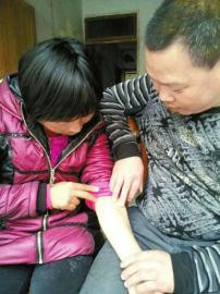 丈夫每天暴走十公里减肥 只为捐肾救爱妻(组图)