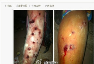 图：血淋淋的上浦村 催泪炸弹满天飞