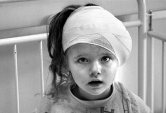 儿童头部电脑扫描或致癌 一半家长不知