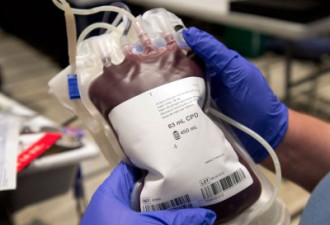 联邦血库未正确检验 1500单位血回收
