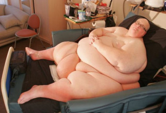 英国52岁男减肥305公斤 感动女子萌生恋情